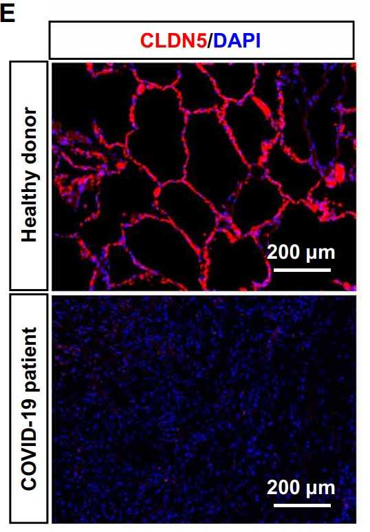 Immunofluorescent staining for CLDN5.jpg